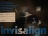 clear removable braces invisalign dentist dentistry in bulgaria